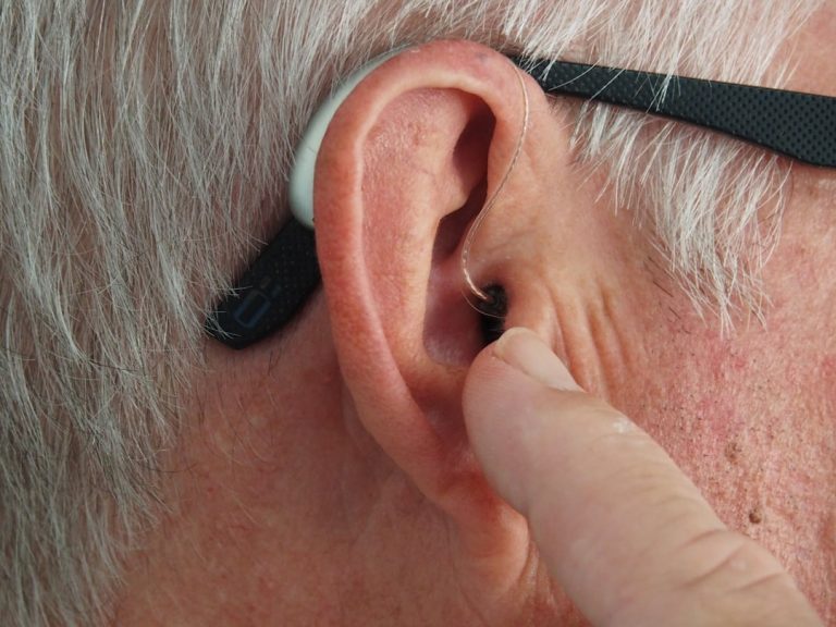 Signia Hearing Aid Prices in South Africa: What Changes the Cost?