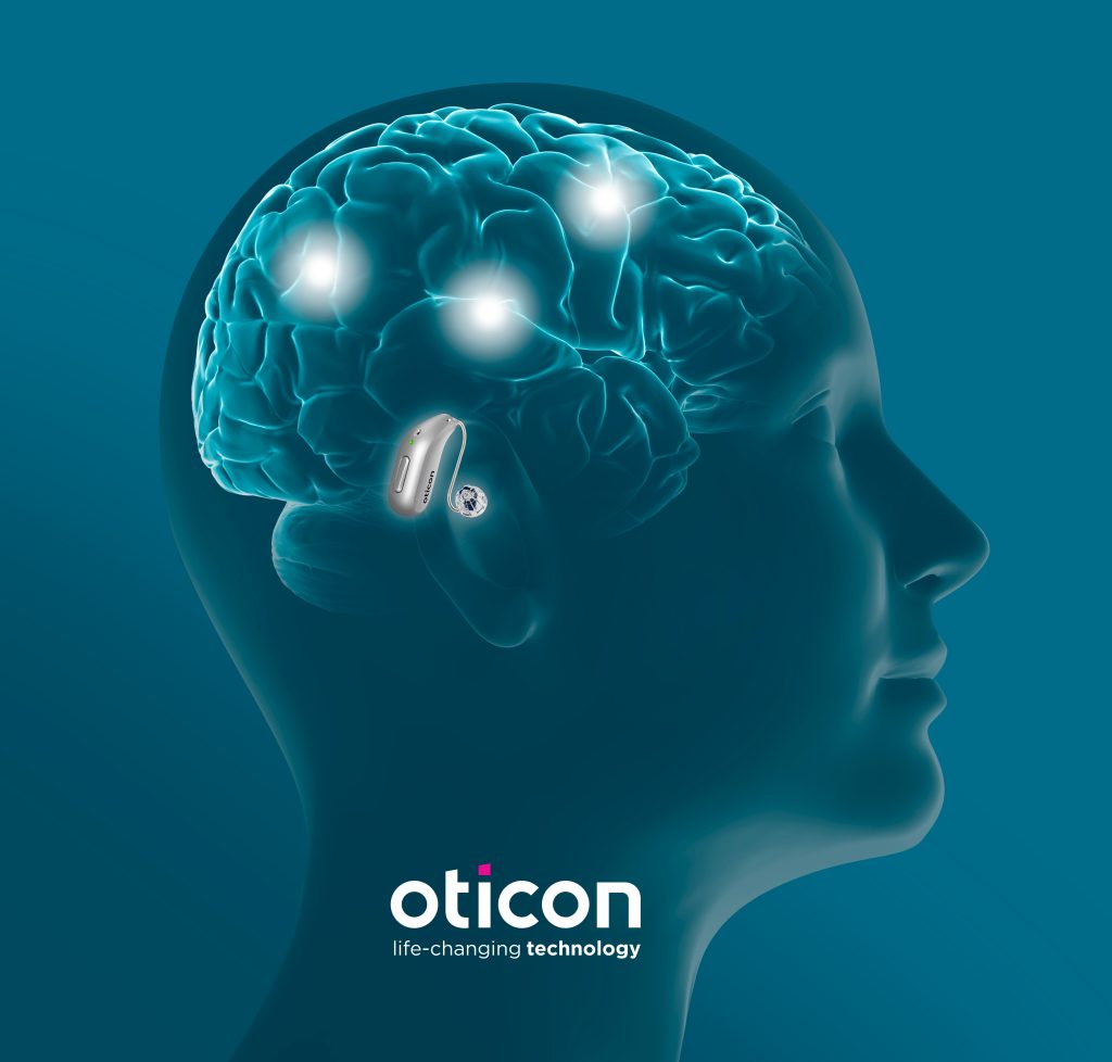 Oticon BrainHearing and deep neural network technology