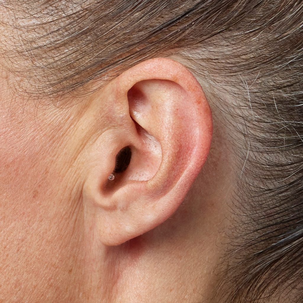 Discreet custom hearing aid worn in the ear